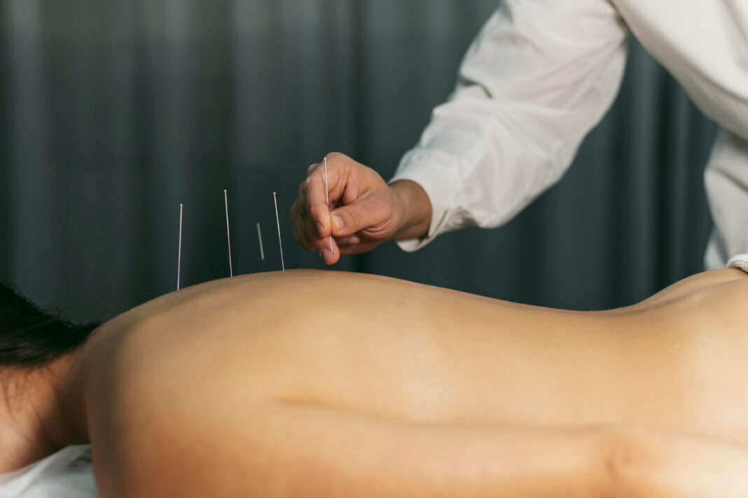 Alegerea Unui Terapeut de Acupunctură Potrivit Pentru Tine: Ghid Detaliat